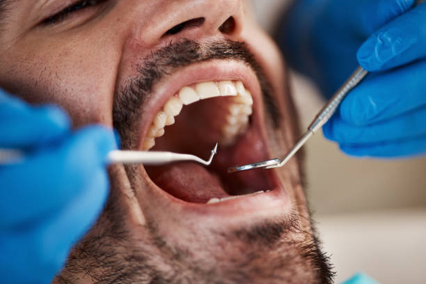 Best Emergency Denture Repair in Englewood Cliffs, NJ